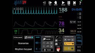 ACLS and PALS Chicago Heart Training Skills Simulation Course [upl. by Somisareg617]