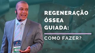 Regeneração Óssea Guiada Técnicas e Materiais [upl. by Ameline]