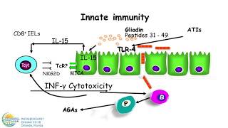 NonCeliac Gluten Sensitivity [upl. by Aliek]