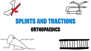 SPLINTS AND TRACTIONS  ORTHOPAEDICS  MED VIDS MADE SIMPLE [upl. by Puna]