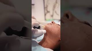 Transform Your Skin with HIFU NonSurgical Facelift Hifu EnfieldRoyalClinic [upl. by Ayeka339]