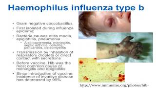 Poliomyelitis  Symptoms and Prevention [upl. by Anej]