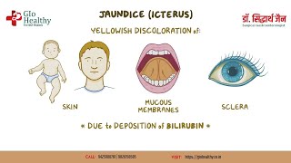 Jaundice Causes Symptoms and Treatment Options  Dr Siddharth Jain [upl. by Jaquelyn580]